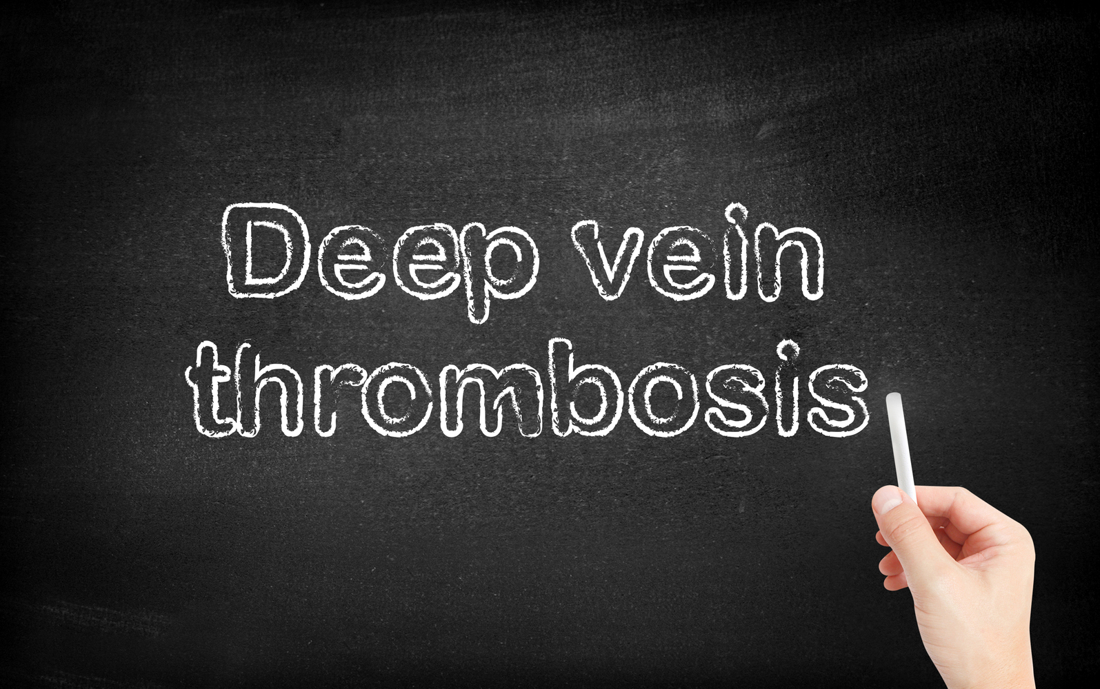 5 Warning Symptoms of Deep Vein Thrombosis