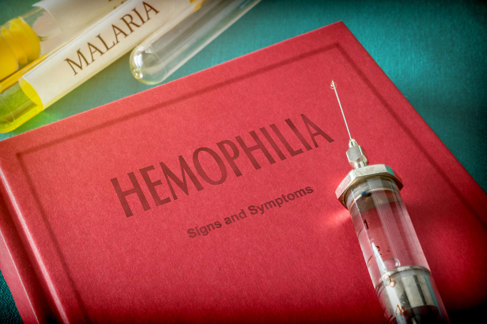 Hemophilia &#8211; Symptoms and Treatment Options