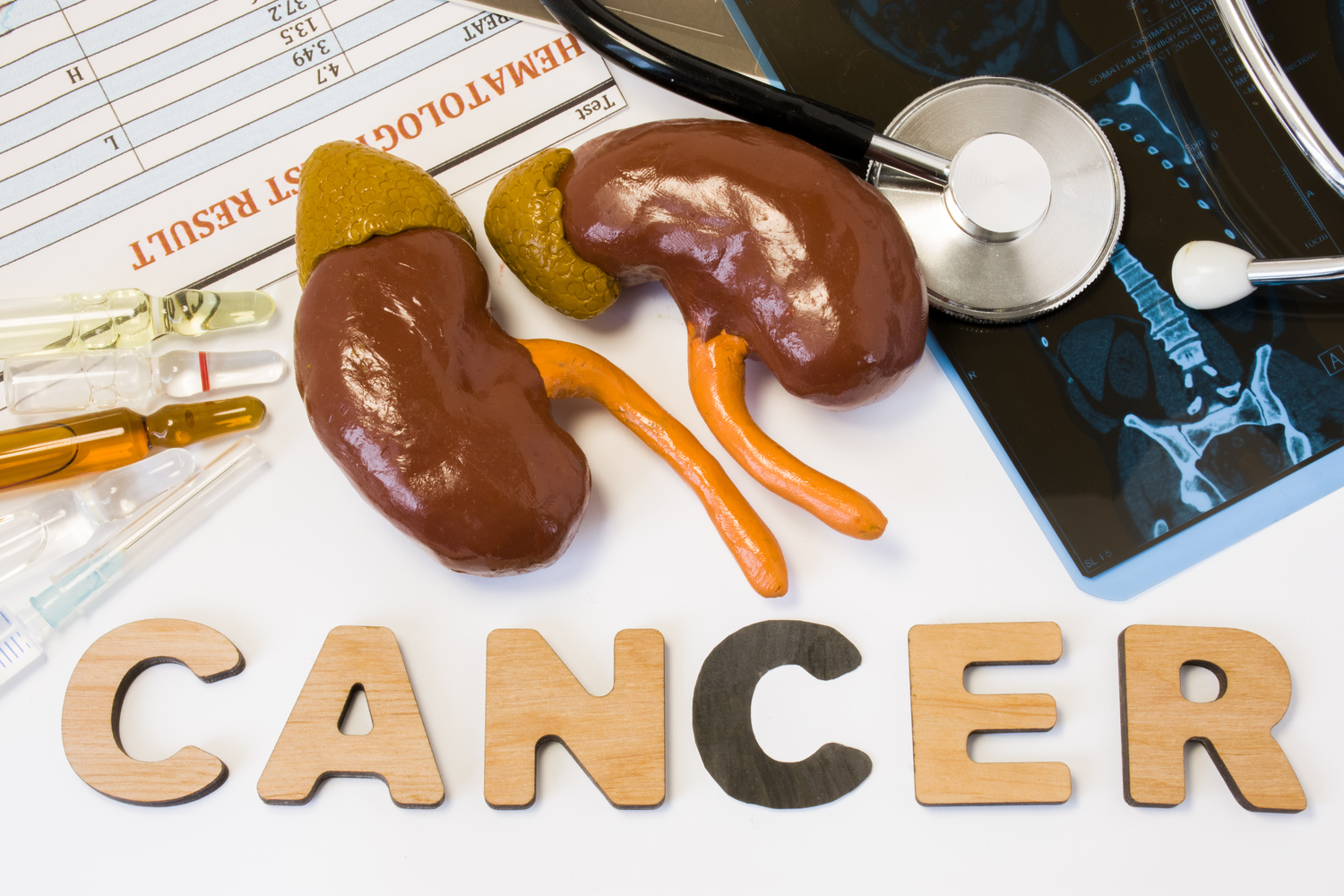 Early Signs of Kidney Cancer